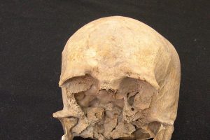 cranio-plinio-1