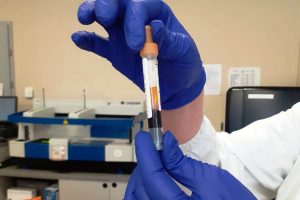 provetta-coronavirus-test-sierologico-3