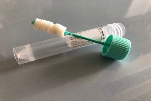 test-salivare-molecolare-covid-coronavirus-tampone